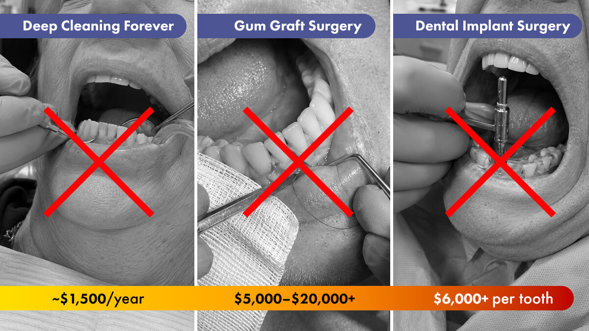 What Fixing Your Gums Really Costs in Canada